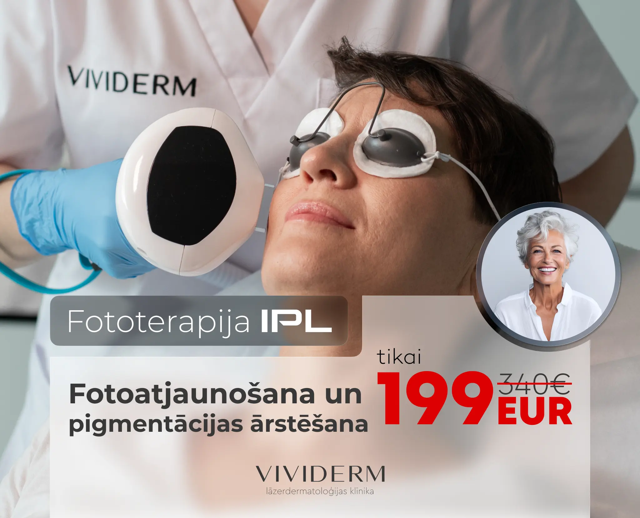 Fotoatjaunošana un pigmentācijas ārstēšana