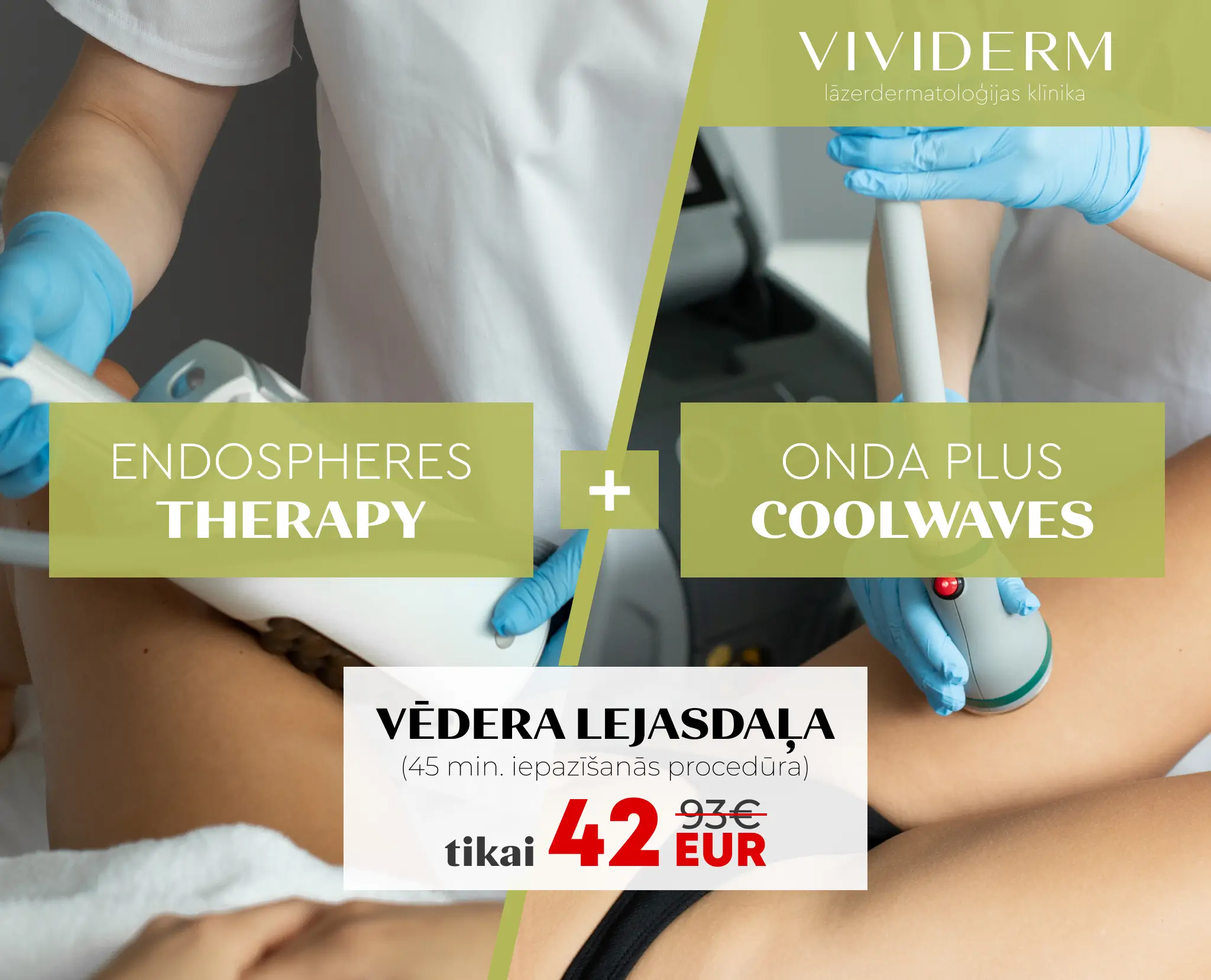 Onda Plus un Endosfēras terapijas iepazīšanās procedūra