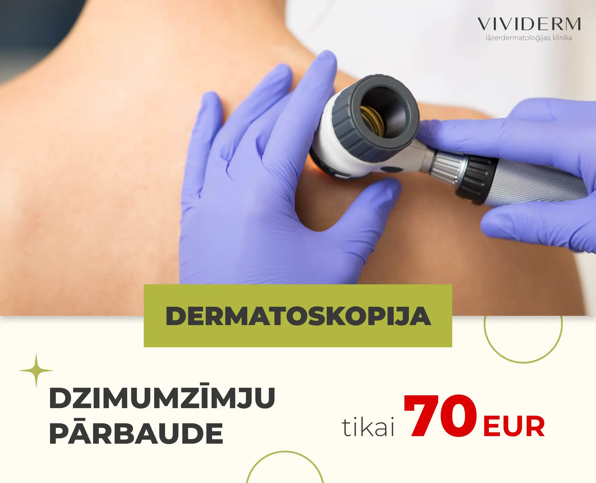 Dermatoskopija dzimumzīmju pārbaude